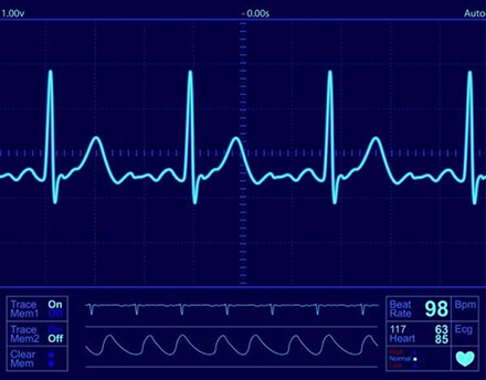 EKG Reading